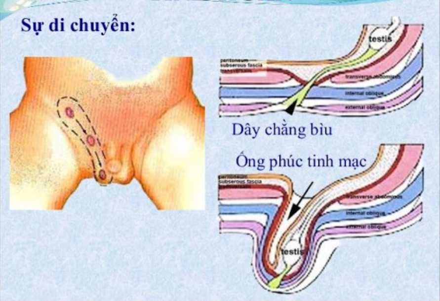 Bệnh lý ống phúc tinh mạc