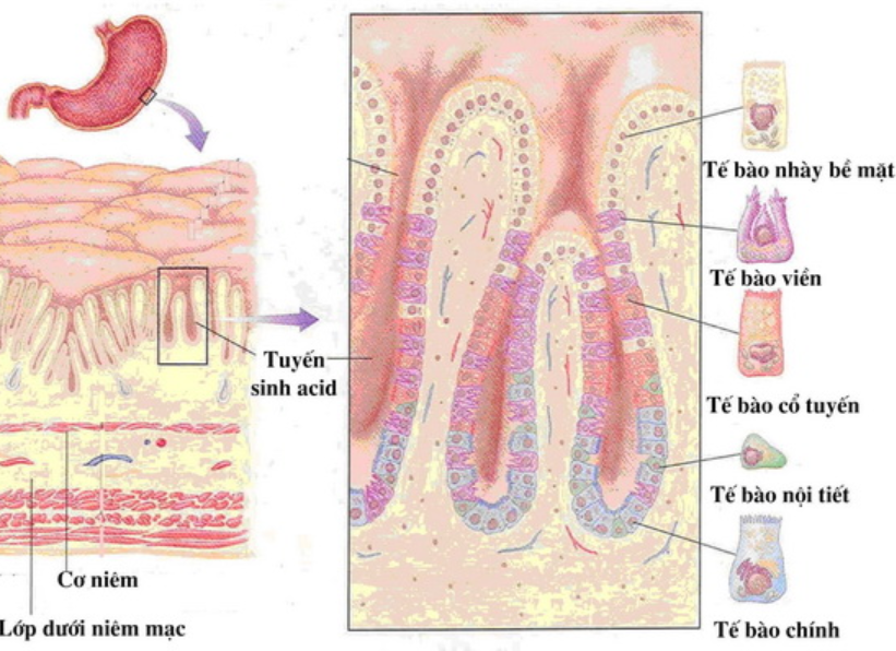 Định nghĩa và cơ chế bệnh sinh của viêm - loét dạ dày tá tràng Định nghĩa và cơ chế bệnh sinh của viêm - loét dạ dày tá tràng