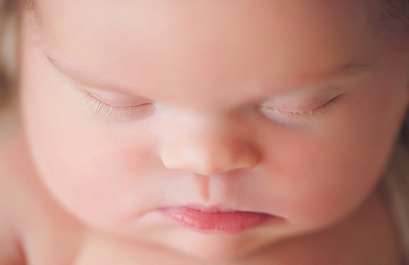Tắc tá tràng ở trẻ sơ sinh: Chẩn đoán và điều trị Tắc tá tràng ở trẻ sơ sinh: Chẩn đoán và điều trị
