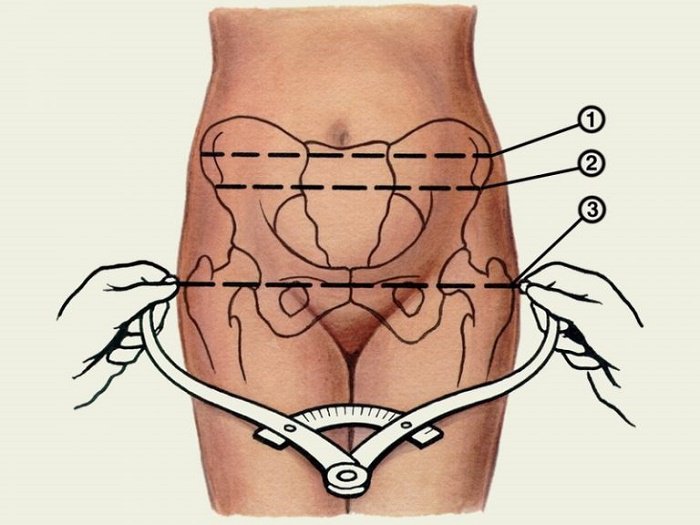 Bất tương xứng đầu chậu