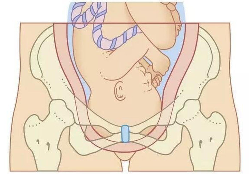 Bất tương xứng đầu chậu Bất tương xứng đầu chậu