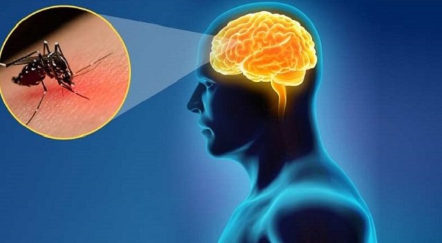 Virus nào gây bệnh viêm não Nhật Bản? | Vinmec