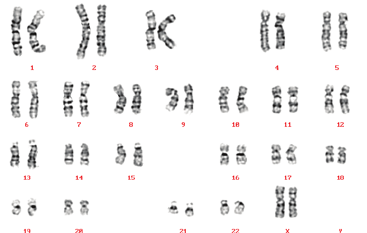 Xét nghiệm công thức nhiễm sắc thể Xét nghiệm công thức nhiễm sắc thể