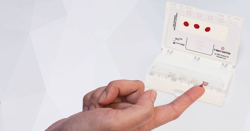 Hướng dẫn cách kiểm tra đường huyết mao mạch tại nhà Hướng dẫn cách kiểm tra đường huyết mao mạch tại nhà