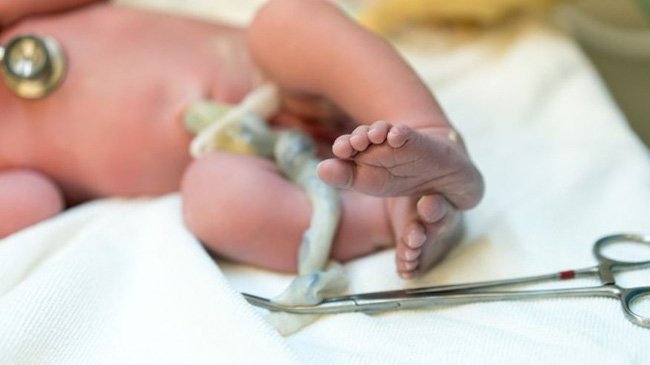 Chăm sóc sơ sinh thiết yếu sớm sau sinh mổ Chăm sóc sơ sinh thiết yếu sớm sau sinh mổ