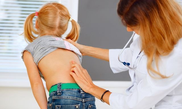 Trật khớp háng bẩm sinh: Những điều cần biết Trật khớp háng bẩm sinh: Những điều cần biết