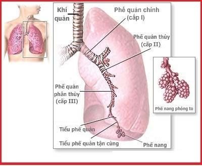 Hít sặc chu phẫu