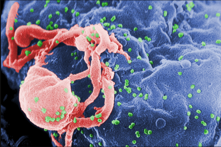 Điều trị và tiêm chủng cho người nhiễm HIV/AIDS Điều trị và tiêm chủng cho người nhiễm HIV/AIDS