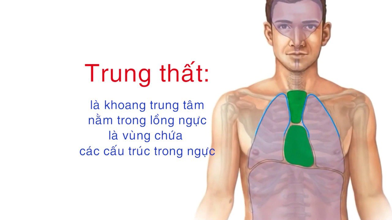 Mổ nội soi lồng ngực cắt bỏ u trung thất Mổ nội soi lồng ngực cắt bỏ u trung thất