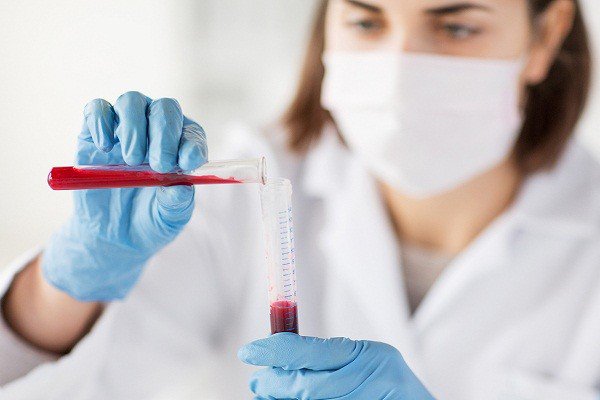Hướng dẫn xem kết quả của nghiệm pháp Coombs Hướng dẫn xem kết quả của nghiệm pháp Coombs