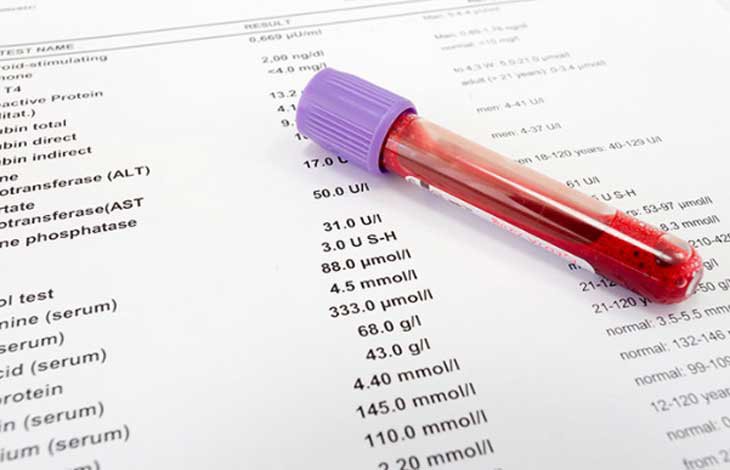 Cần xét nghiệm chức năng gan trước khi tiến hành điều trị