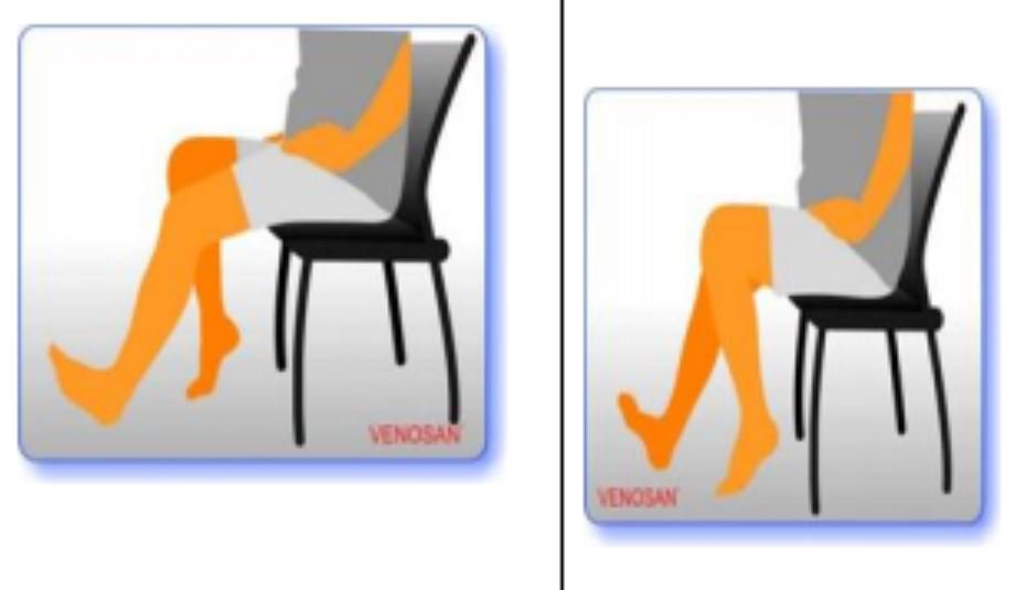 Exercises to treat patients with venous insufficiency of the legs Vinmec