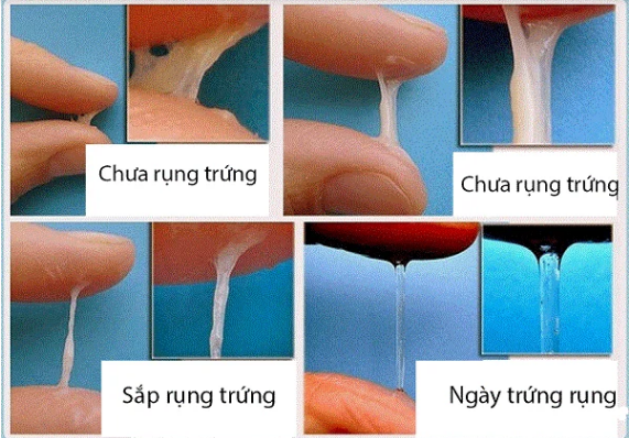 Chất nhầy cổ tử cung