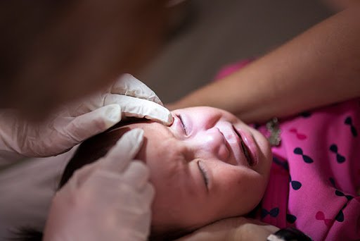 Chẩn đoán và điều trị viêm kết mạc do tắc tuyến lệ ở trẻ sơ sinh Chẩn đoán và điều trị viêm kết mạc do tắc tuyến lệ ở trẻ sơ sinh