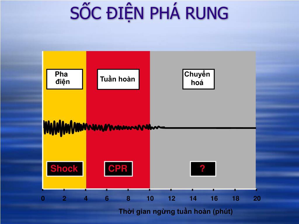 Electric shock in the treatment of cardiac arrhythmias Vinmec