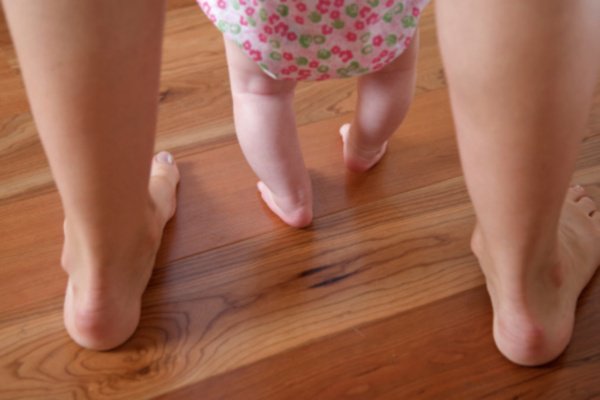 Làm cách nào để biết trẻ có bị chân vòng kiềng hay không? Làm cách nào để biết trẻ có bị chân vòng kiềng hay không?
