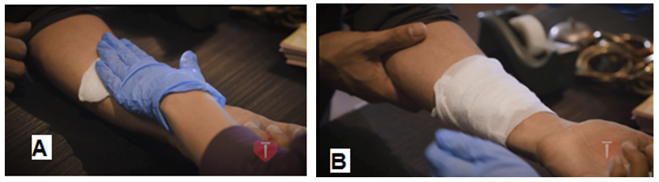 Cầm máu vết thương