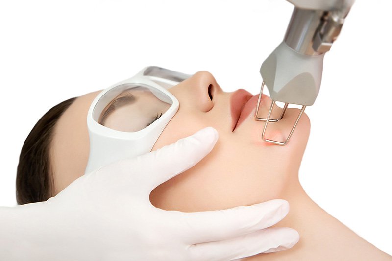Trẻ hóa da bằng laser fractional CO2