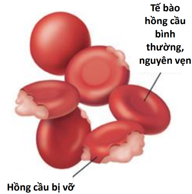 Bé thiếu men G6PD có dùng vitamin tổng hợp được không? Vinmec