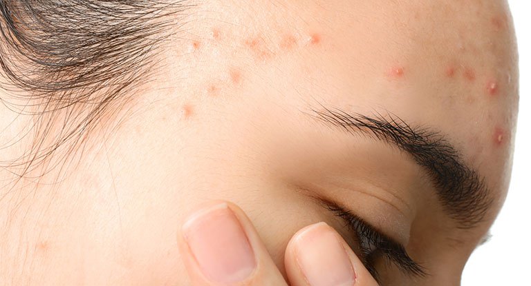 7 vấn đề khiến bạn khó xử khi mang thai 7 vấn đề khiến bạn khó xử khi mang thai