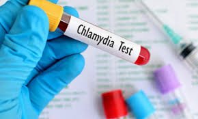 Xét nghiệm Chlamydia IgG và Chlamydia IgA Xét nghiệm Chlamydia IgG và Chlamydia IgA