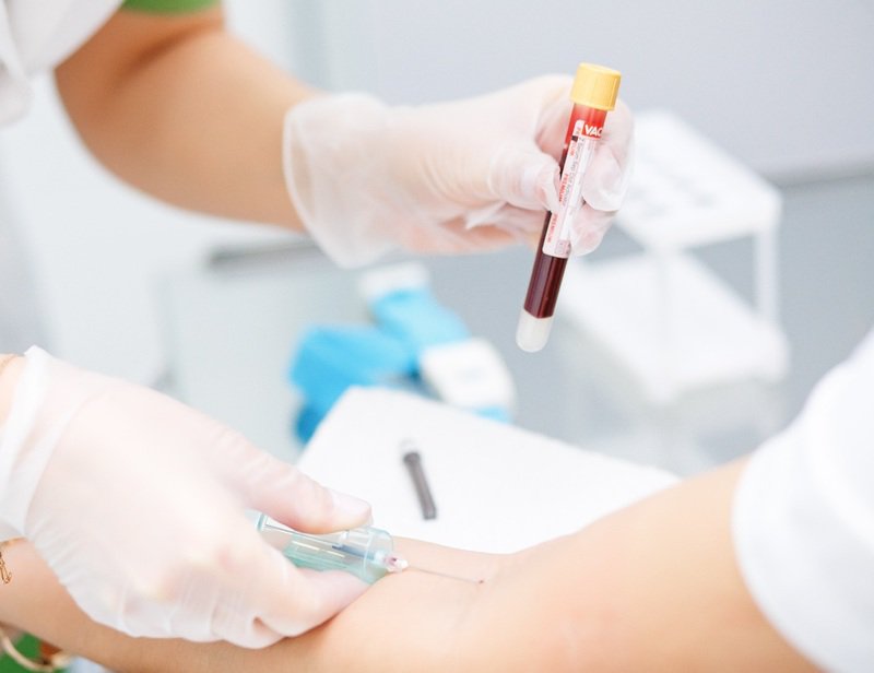 meaning-of-cmv-dna-test-vinmec