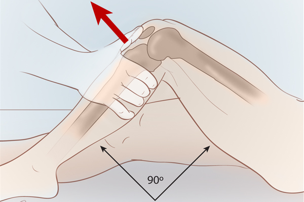 Sự lỏng lẻo dây chằng ở đầu gối, vai, mắt cá chân, cổ Sự lỏng lẻo dây chằng ở đầu gối, vai, mắt cá chân, cổ