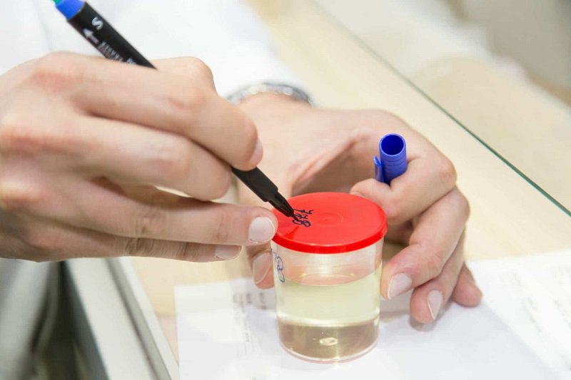 Xét nghiệm nước tiểu nói gì về bệnh tiểu đường? Xét nghiệm nước tiểu nói gì về bệnh tiểu đường?