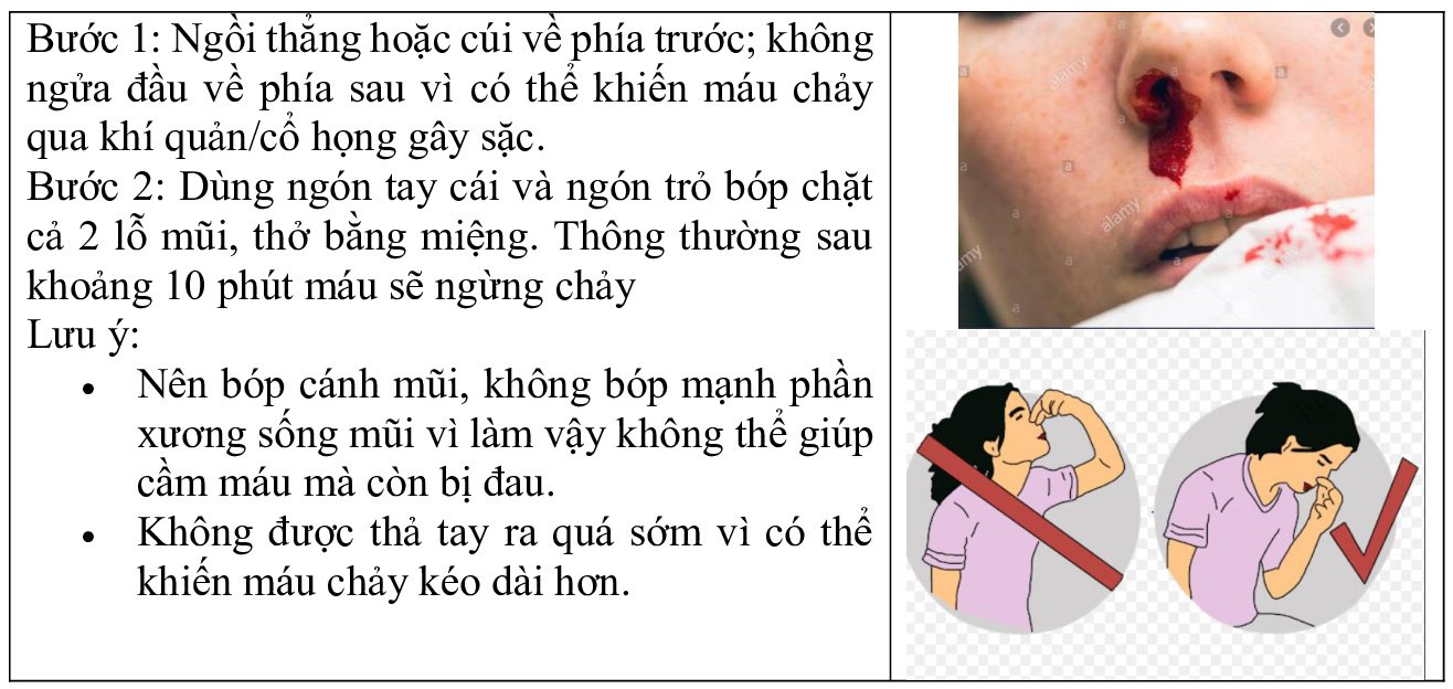 sơ cứu chảy máu