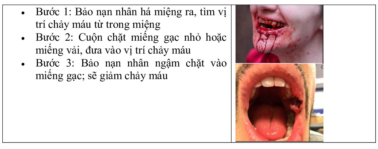 chảy máu từ miệng