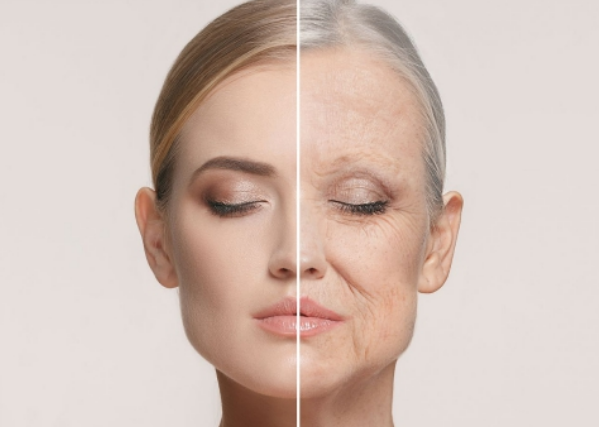 Mọi thứ bạn cần biết về độ săn chắc của da