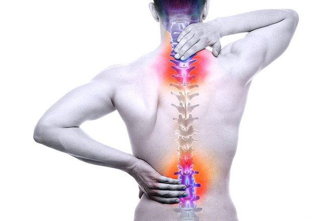 Vỡ lún cột sống làm cho cơ thể đau nhức