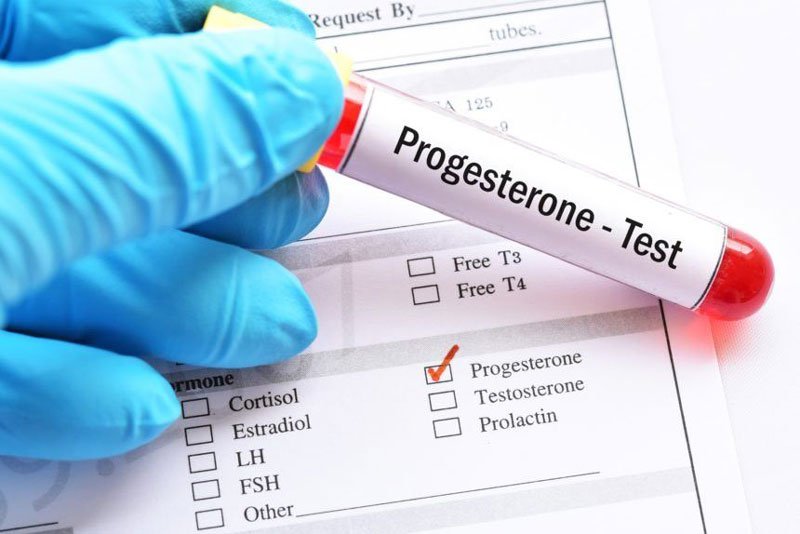 What types of female hormone tests are there? Vinmec