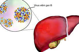 Đánh bàn chải của người bị viêm gan B thể không hoạt động có sao không?