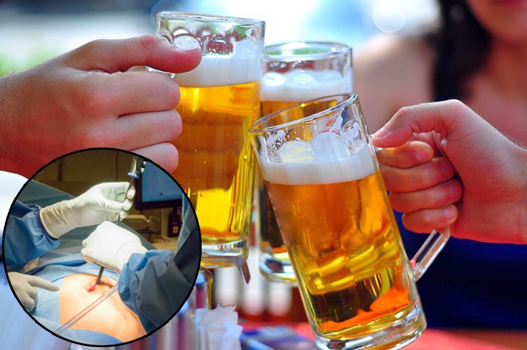 Does drinking alcohol negate the anesthetic effect of appendectomy