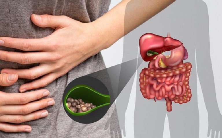 Is bile reflux with stomach pain dangerous? | Vinmec