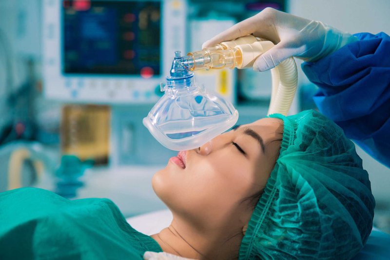 What is endotracheal anesthesia? Vinmec