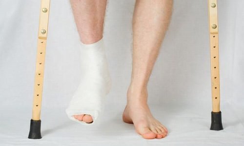 Cách chăm sóc bệnh nhân sau bó bột